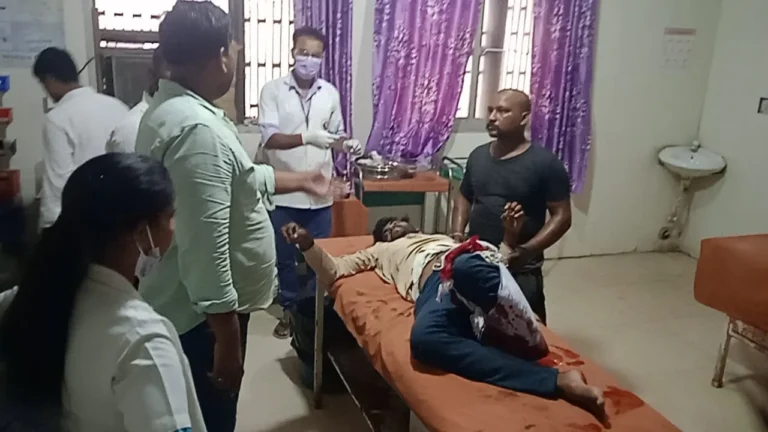 ट्रेन से गिरकर युवक का पैर कटा, गंभीर हालत में हायर सेंटर रेफर